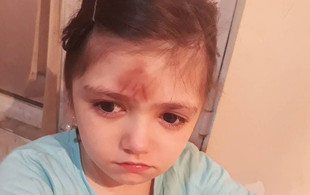1-ci sinif şagirdini döyən müəllim işdən çıxarıldı