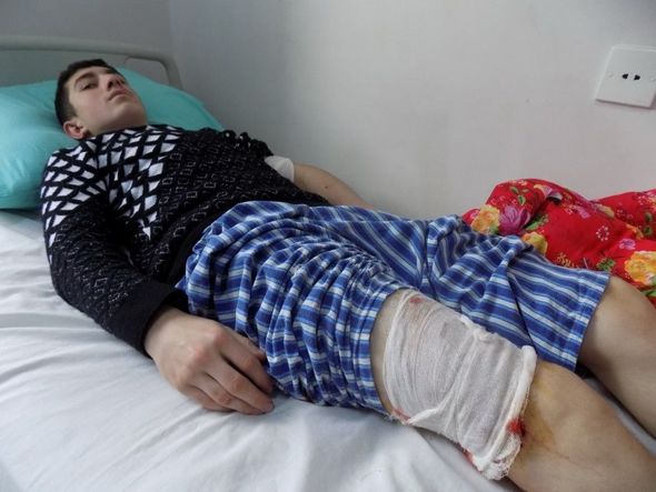 Astarada canavarlar məktəblilərə hücum edib - FOTO