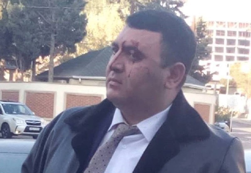 Aktyorla məktəb direktoru arasındakı insidentə görəcinayət işi başlandı