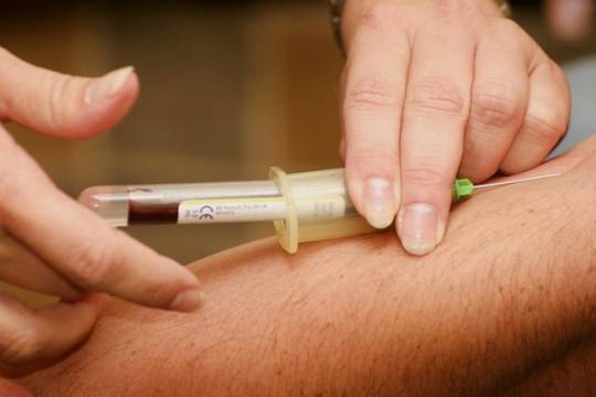 Qan testi ilə ölüm tarixini öyrənmək mümkün olacaq - Yeni araşdırma