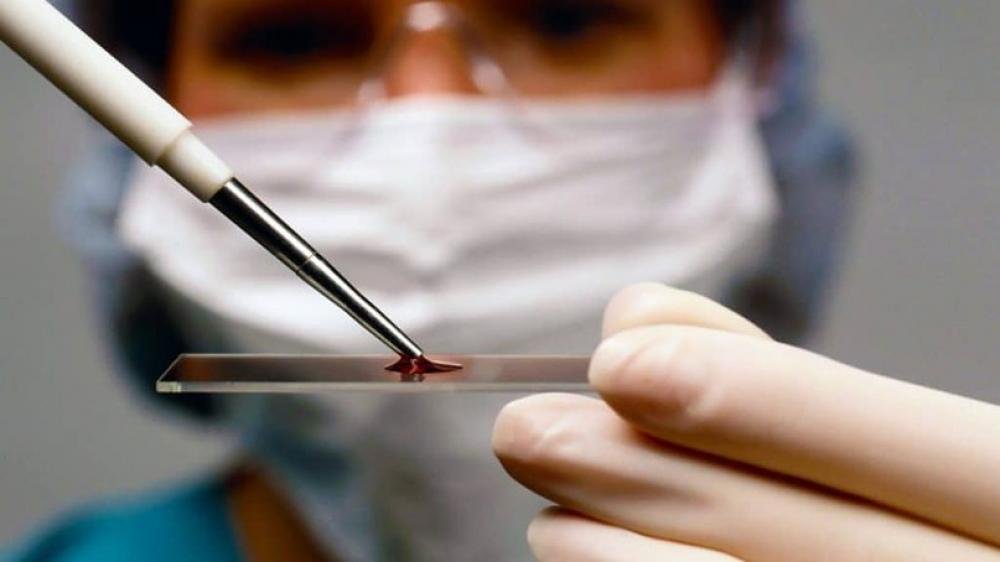 Tibbdə texnoloji inqilab: Batareyasız ən kiçik biosensor