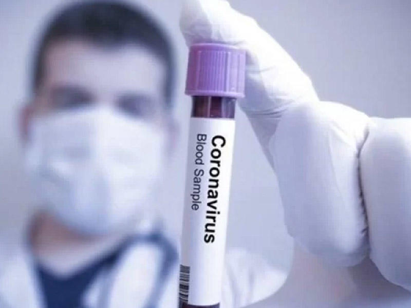 Türk professordan sensasiyalı resept: “Koronovirus qorxulu deyil, bunu etsəniz...”