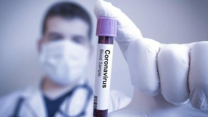 Oksford Universitetinin tədqiqatçıları koronavirus əleyhinə vaksinin sınaqlarına başladı
