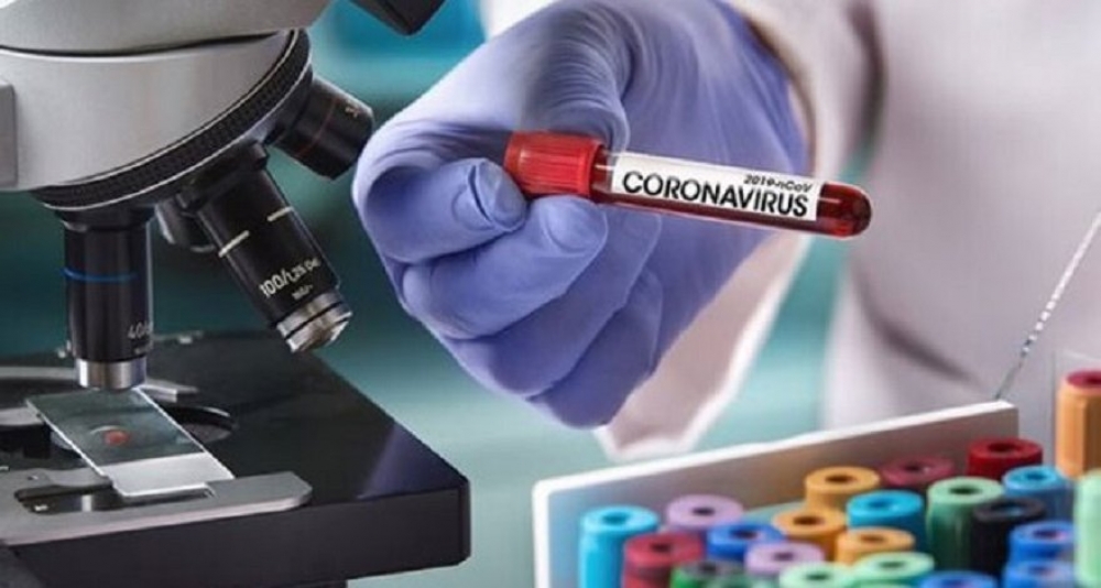 Koronavirusun ötürülməsini tez bir zamanda bloklayan preparat aşkarlandı