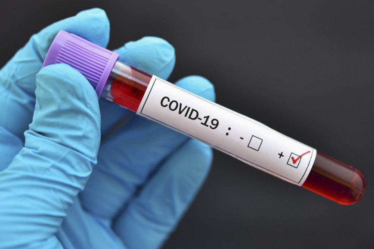 Amerikalı alimlər insan üçün təhlükə yaradan yeni koronavirus aşkarlayıblar