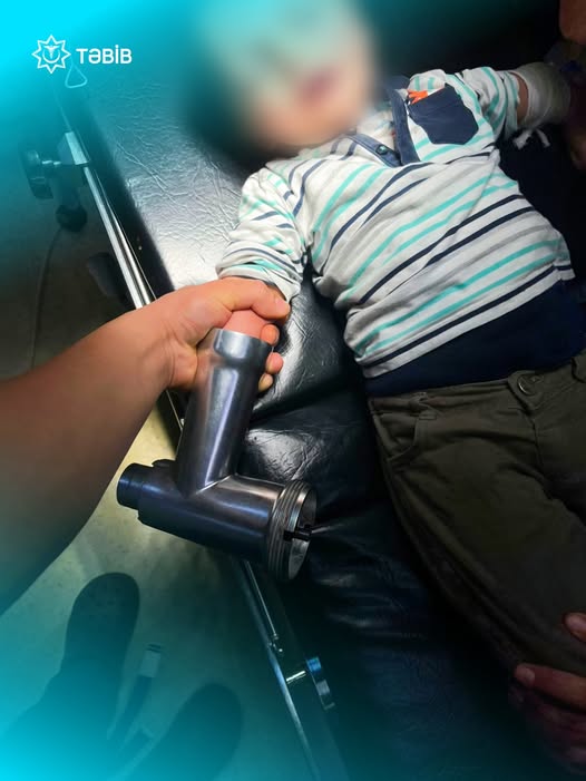 Əli ətçəkən maşında qalan azyaşlının həyatı xilas edildi