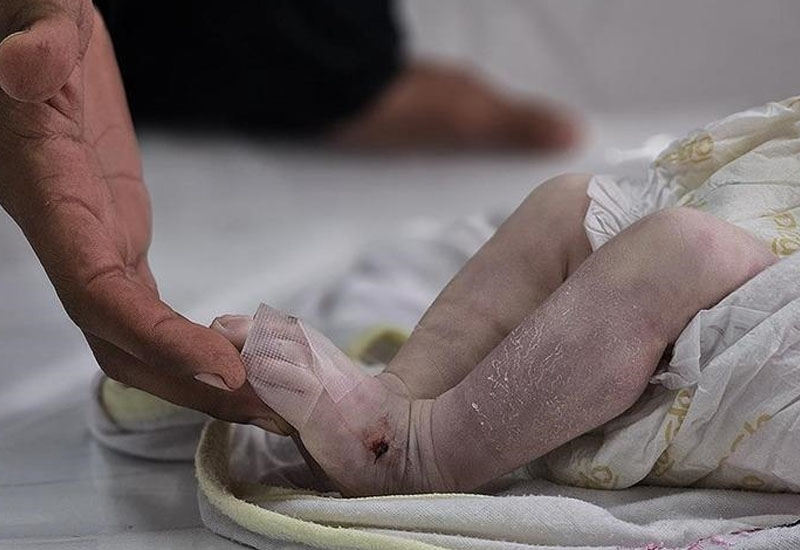 Qəzzada 7 aylıq körpə soyuqdan həyatını itirdi