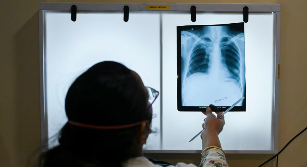 24 mart Beynəlxalq Vərəmlə Mübarizə günüdür